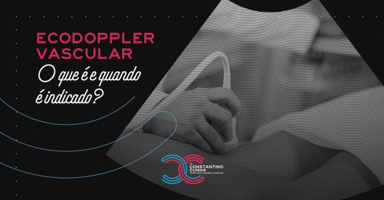 Ecodoppler Vascular: O que é e quando é indicado?