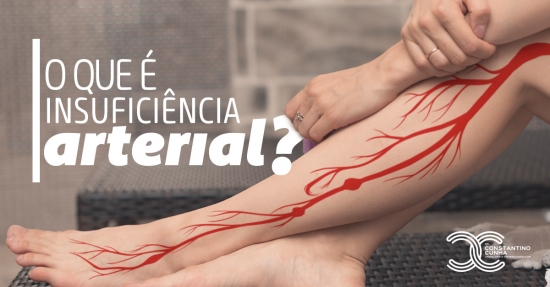 O que é insuficiência arterial?