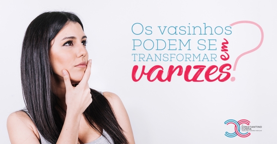 Os vasinhos podem se transformar em varizes?