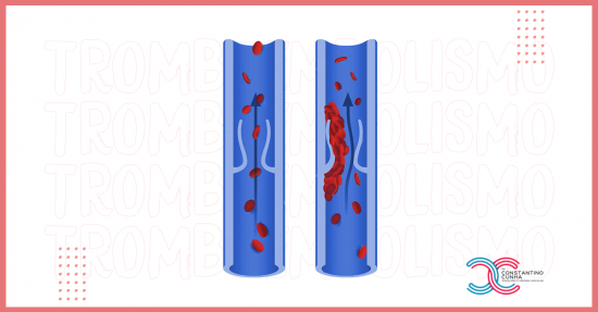 O que é Tromboembolismo Venoso e quais suas complicações?
